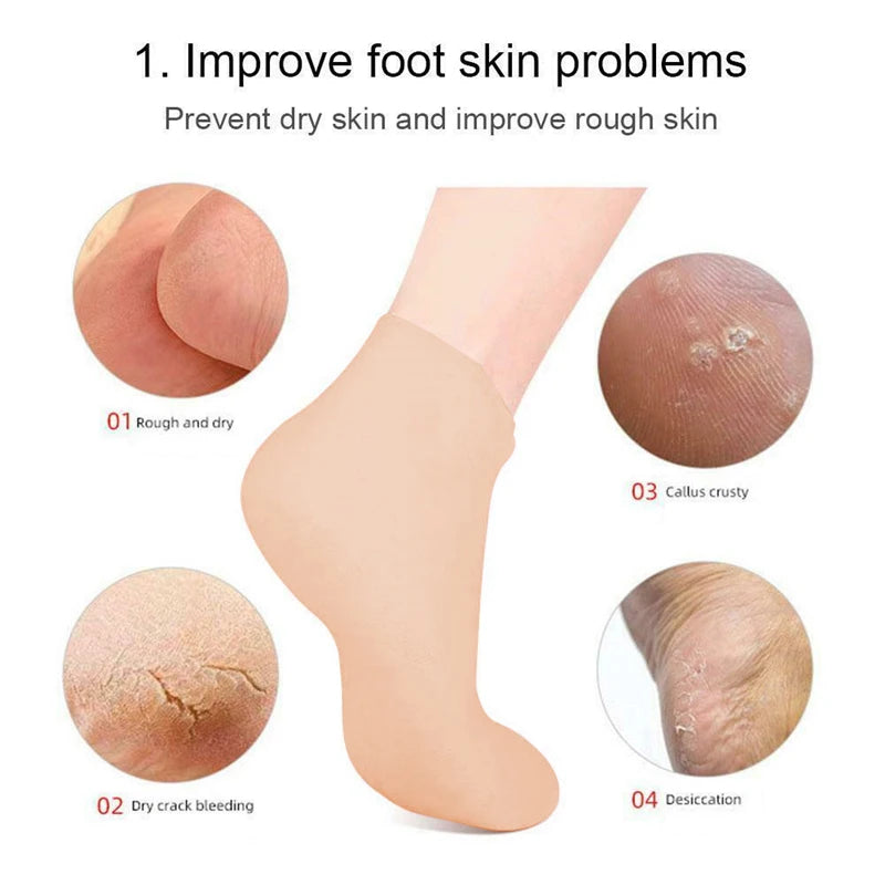 "Silky Soft Moisturizing Gel Heel Socks - Say Goodbye to Cracked Foot Skin with This Foot Care Miracle!"